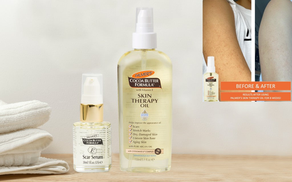 palmers scar serum and skin therapy oil on a bathroom counter showing before and after results